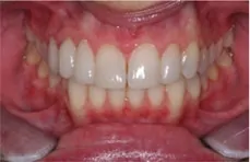Warsaw Dentist - Dr. William Myers